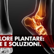 Il dolore plantare: cause e soluzioni
