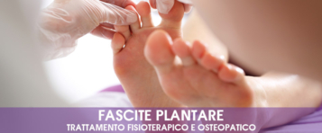 Fascite plantare: trattamento fisioterapico e osteopatico