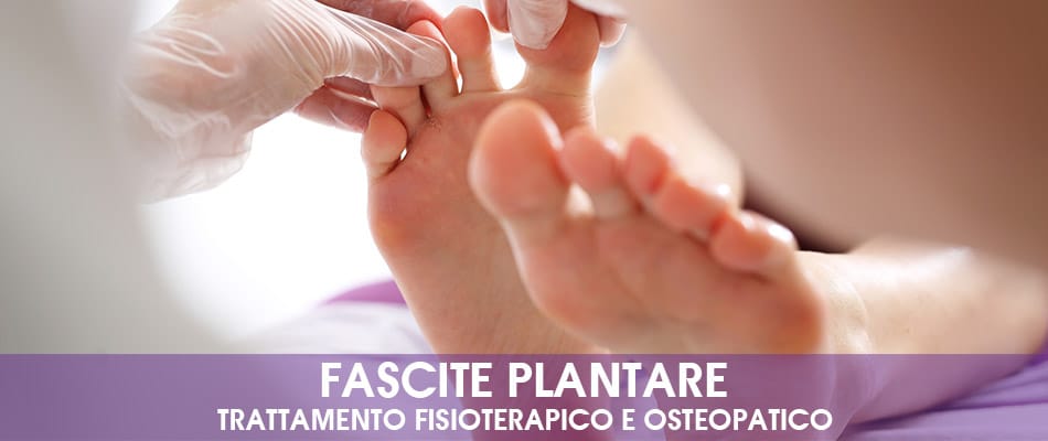 Fascite plantare: trattamento fisioterapico e osteopatico