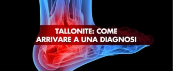 Tallonite: come arrivare a una diagnosi