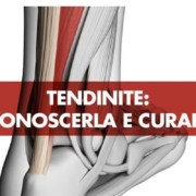 Come riconoscere la tendinite?