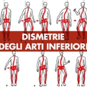 Dismetrie degli arti inferiori