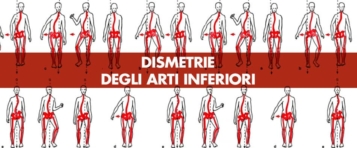 Dismetrie degli arti inferiori