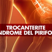 Trocanterite e sindrome del piriforme