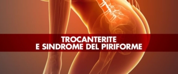 Trocanterite e sindrome del piriforme