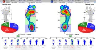 Valutazione podologica e posturale: esame comprensivo di esame baropodometrico in statica e dinamica con analisi del cammino