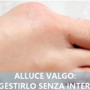 Alluce valgo senza intervento: come gestire la patologia