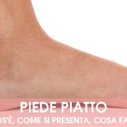 piede piatto: sintomi, cause, rimedi