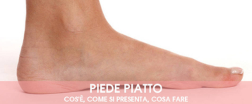 piede piatto: sintomi, cause, rimedi