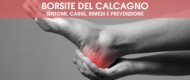 Borsite del calcagno (retrocalcaneare): sintomi, cause, rimedi e prevenzione