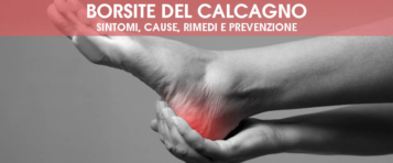 Borsite del calcagno (retrocalcaneare): sintomi, cause, rimedi e prevenzione