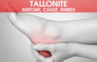 Tallonite: sintomi, cause e rimedi