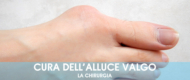 Cura dell'alluce valgo con chirurgia