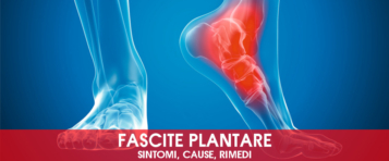 Fascite plantare: sintomi, cause, rimedi