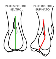 Esempio di supinazione