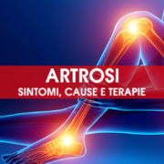 Artrosi: sintomi, cause e terapie