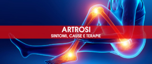 Artrosi: sintomi, cause e terapie