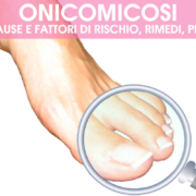 Onicomicosi: sintomi, cause, rimedi, prevenzione