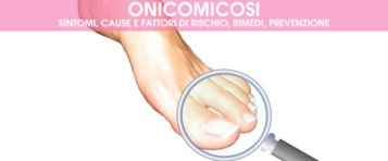 Onicomicosi: sintomi, cause, rimedi, prevenzione